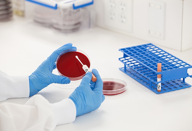 Staphylococcus aureus Slide, w.m.: Science Lab Microbiology Supplies:  : Industrial & Scientific